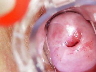 Fette Krankenschwester macht es sich vor der Kamera